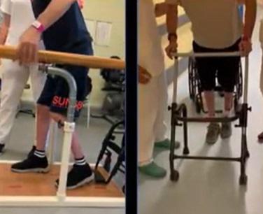 neurostimolatore midollare neurostimolatore midollare