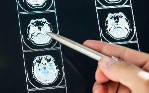 intelligenza artificiale