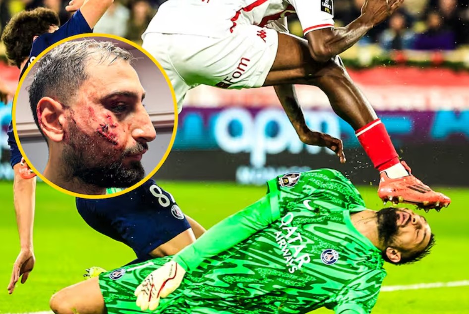 donnarumma ferito donnarumma ferito