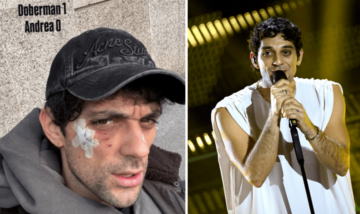 Bresh colpito al volto da un Dobermann, le condizioni del cantante Bresh colpito al volto da un Dobermann, le condizioni del cantante