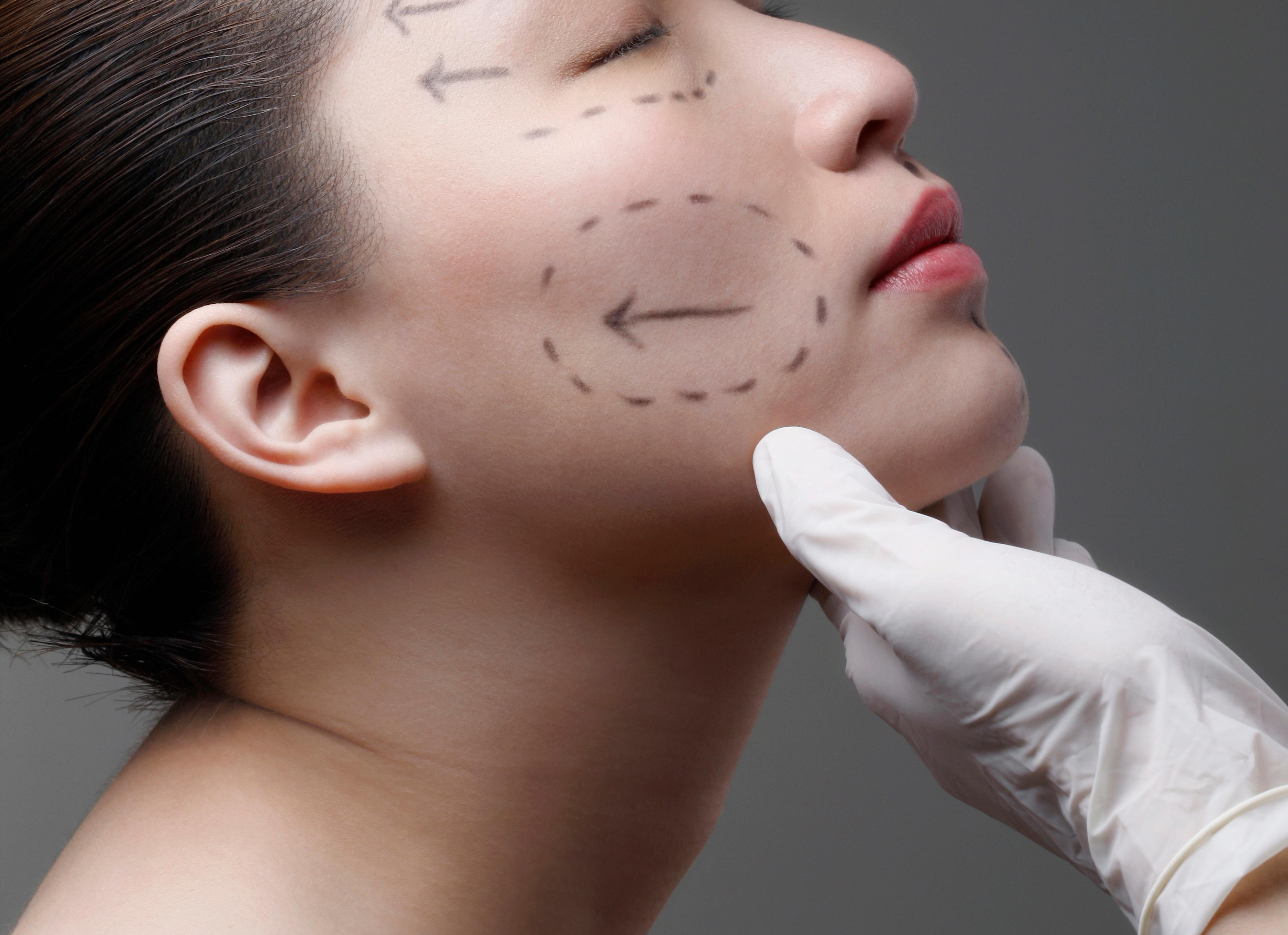 chirurgia estetica chirurgia estetica