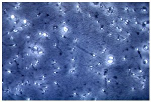 microplastiche nella