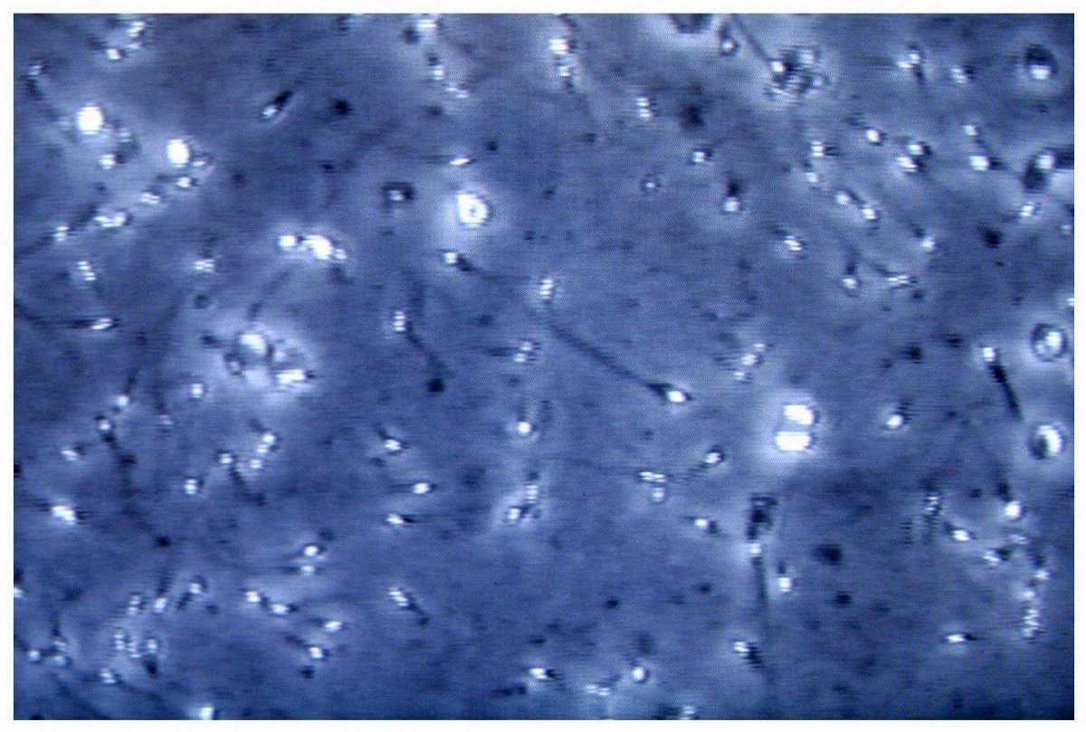 Microplastiche nella prostata e nel liquido seminale, studio dell