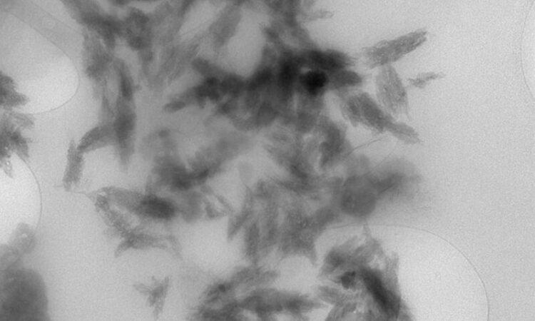 aumento delle aumento delle