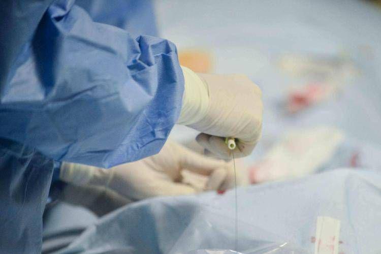 scheggia plastica scheggia plastica