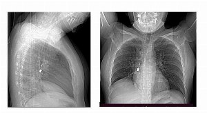 cacciavite odontoiatrico