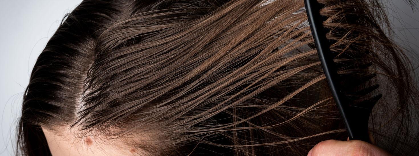 capelli grassi capelli grassi