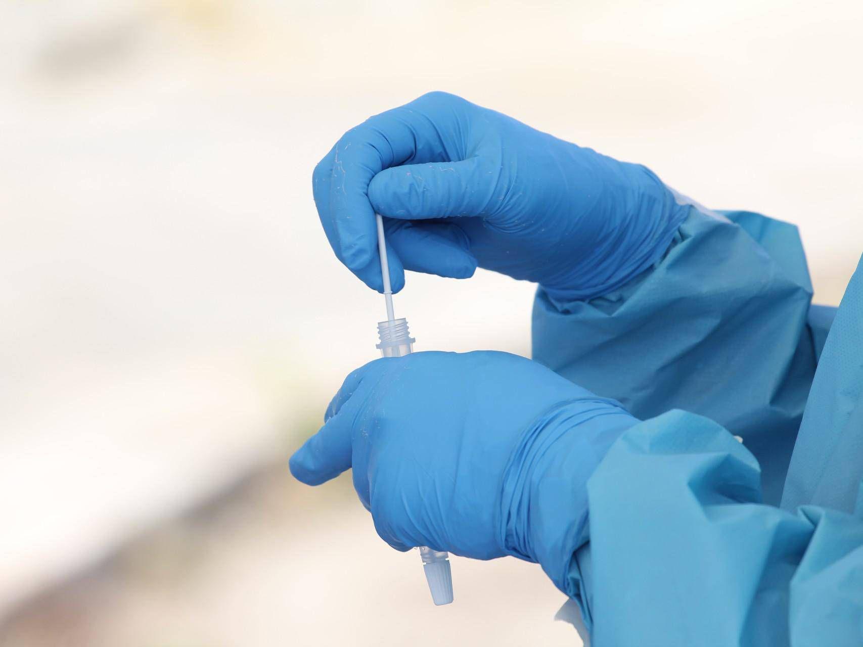 test salivare test salivare