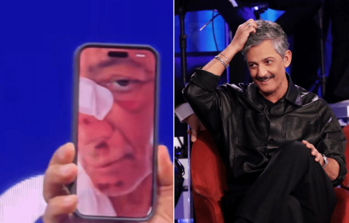 Fiorello racconta la caduta in bici: Volevo fare il figo, sono finito di faccia Fiorello racconta la caduta in bici: Volevo fare il figo, sono finito di faccia