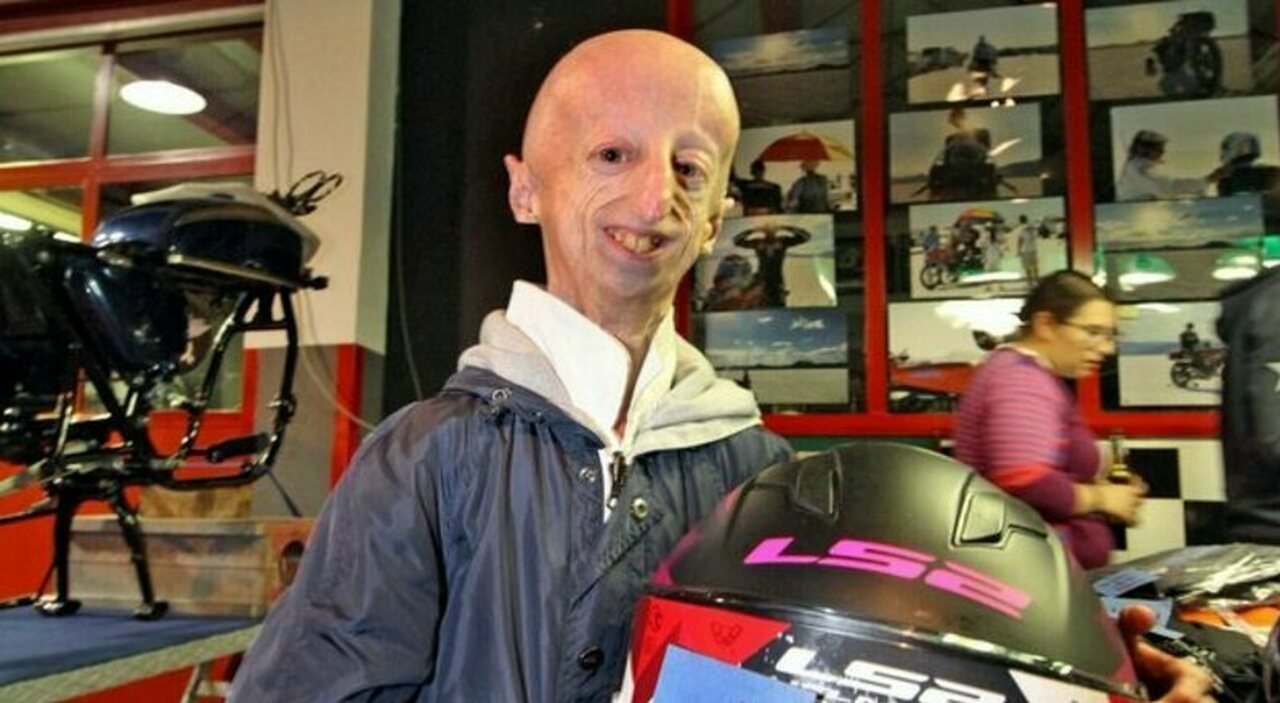 Sammy Basso, il ricordo dei genitori tra progeria e lettere d