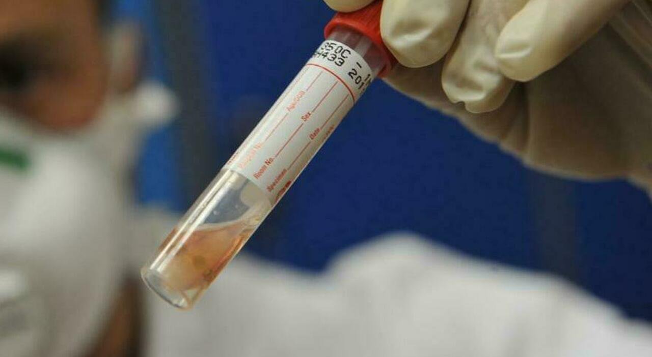 Covid, effetti temporanei sulla fertilità maschile: cosa emerge dagli studi Covid, effetti temporanei sulla fertilità maschile: cosa emerge dagli studi