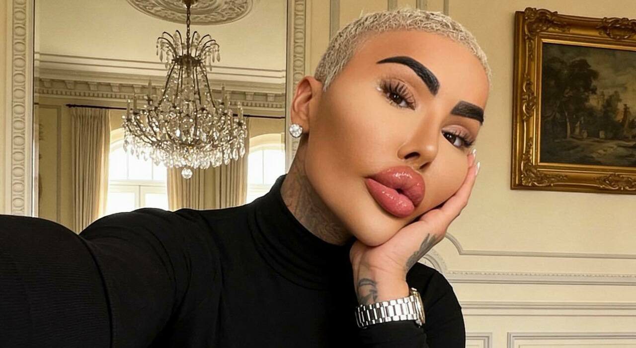 Jordan James Parke morto a 34 anni, il Lip King e gli interventi per imitare Kim Kardashian