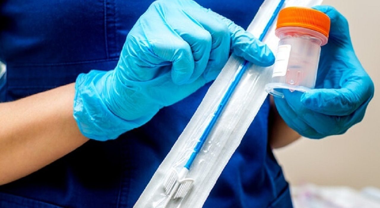 Tre pap test negativi e diagnosi tardiva di tumore all