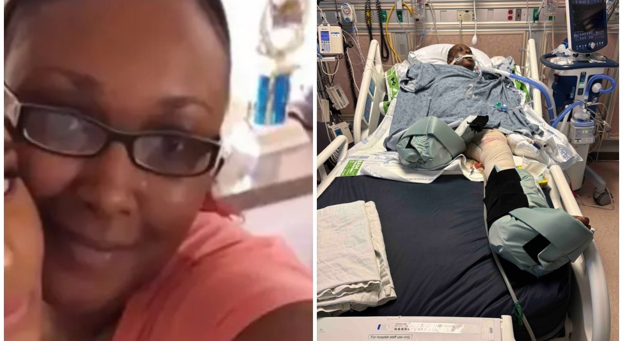 Donna muore dopo aggressione di cani in Carolina del Nord