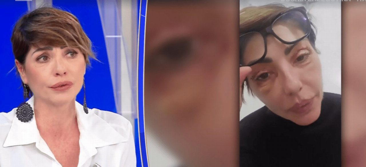 Ilaria Galassi attaccata sui social dopo la blefaroplastica