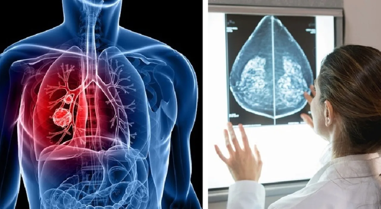 Tumori, rischio più alto per chi non si è mai sposato secondo uno studio Usa Tumori, rischio più alto per chi non si è mai sposato secondo uno studio Usa