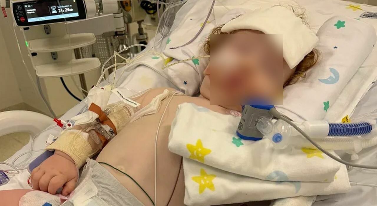 Bimbo di 14 mesi in terapia intensiva, la polvere per dolci gli danneggia i polmoni
