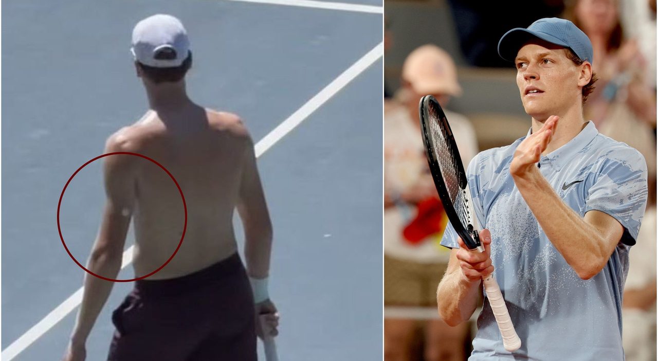 Jannik Sinner a Montecarlo con il sensore per la glicemia, come prepara Wimbledon dopo il Roland Garros