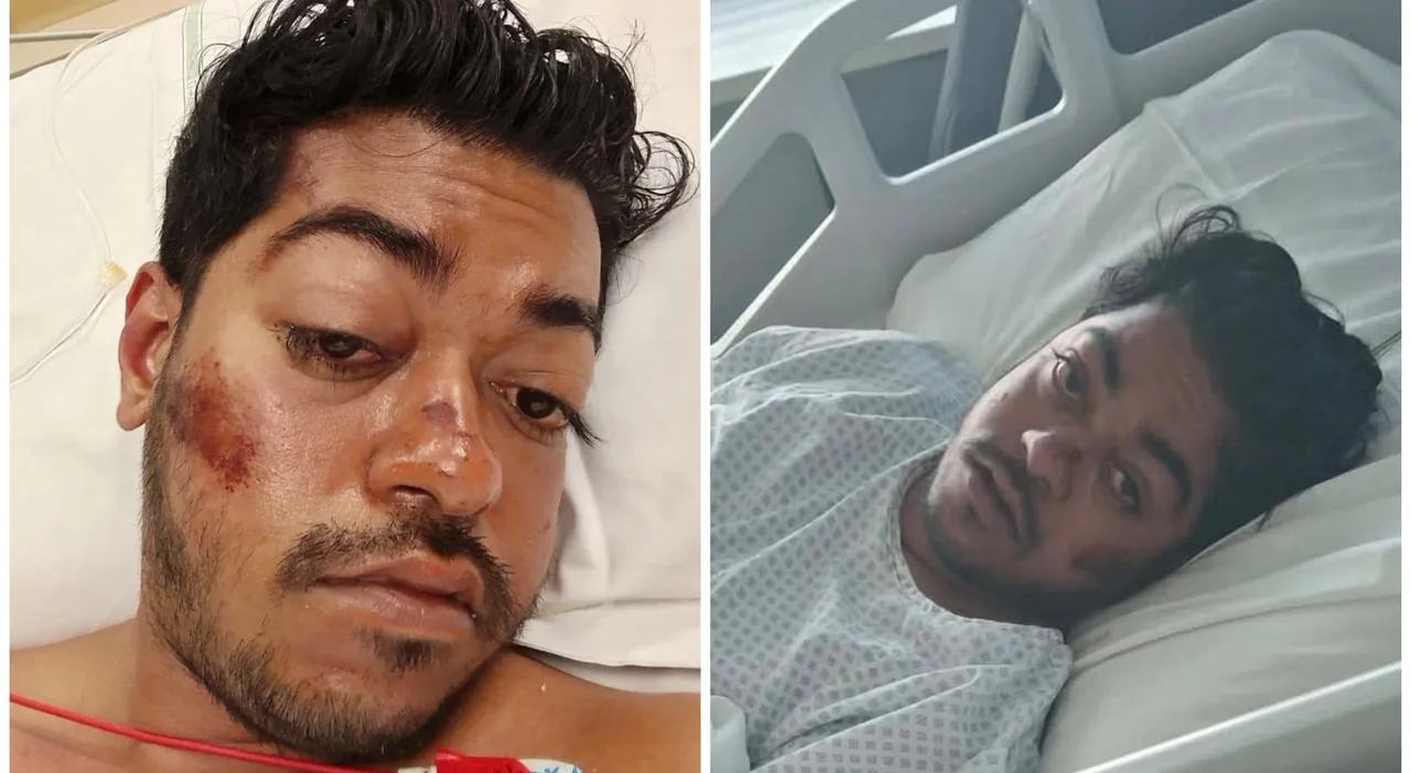 Aiuto cuoco muore dopo un violento pestaggio a Marghera, aperta un