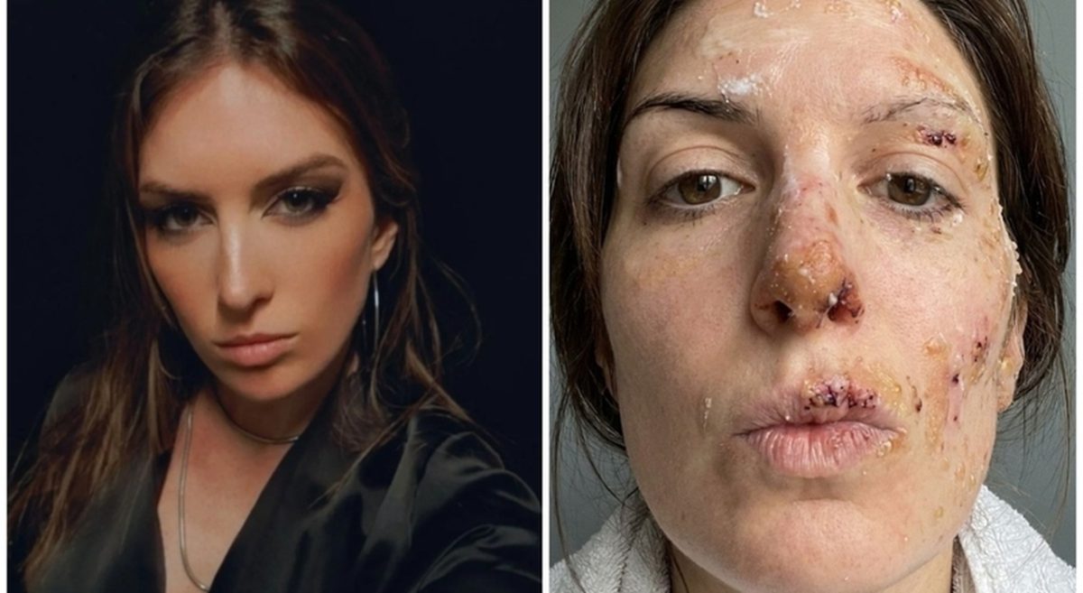 Crans-Montana, Eleonora Palmieri contro la riapertura dei locali legati agli indagati