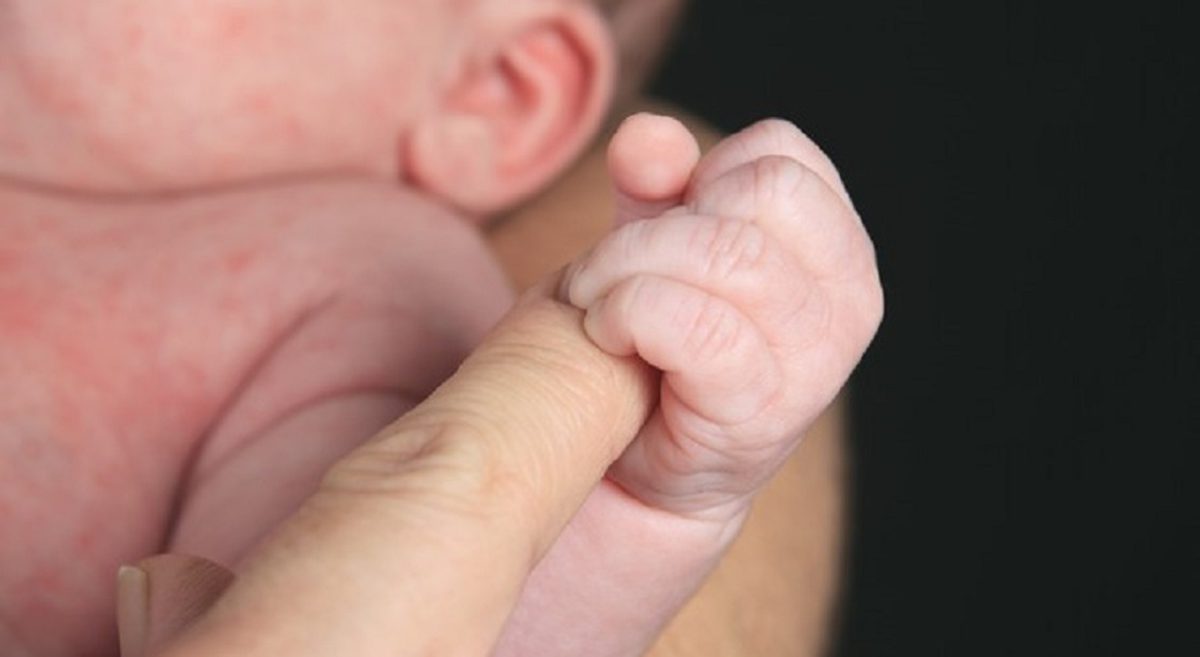 Circoncisione in casa nel Bresciano, neonato ferito e cardiologo denunciato