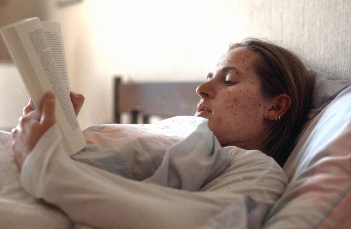 Morbillo in aumento, Pregliasco richiama giovani e adulti al controllo delle due dosi