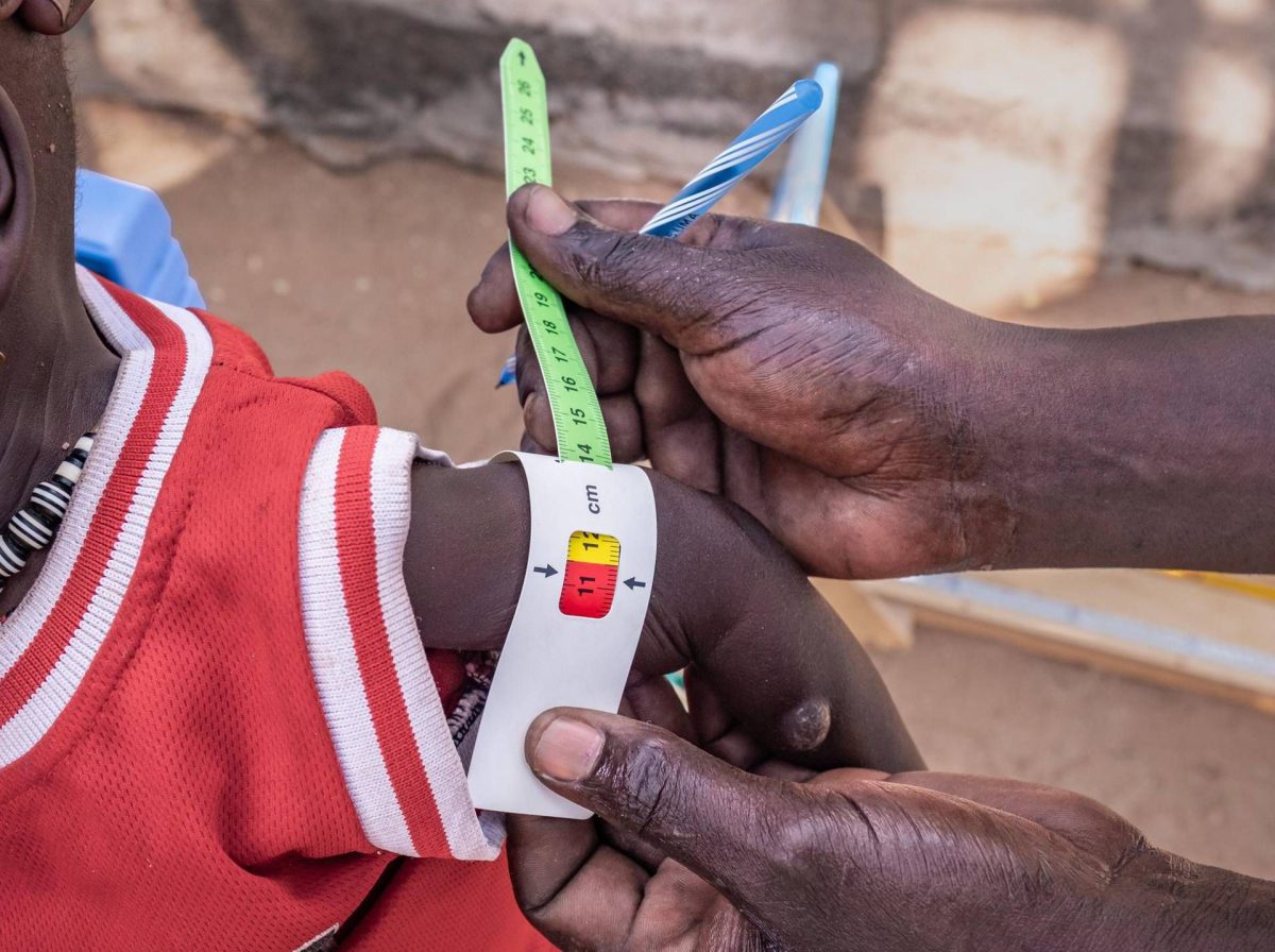 Fame infantile, Save the Children: 181 milioni di piccoli senza un