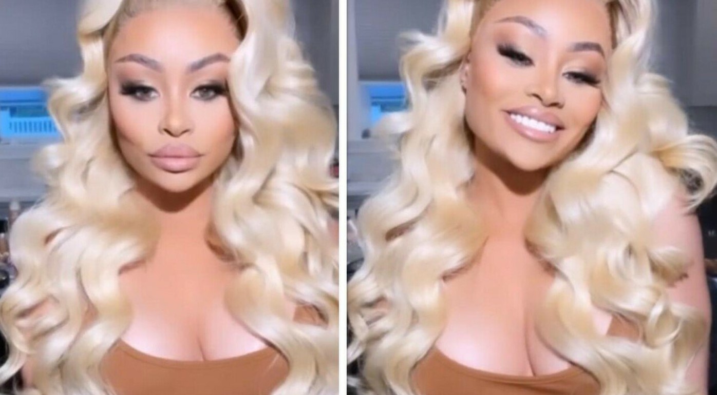protesi influencer protesi influencer