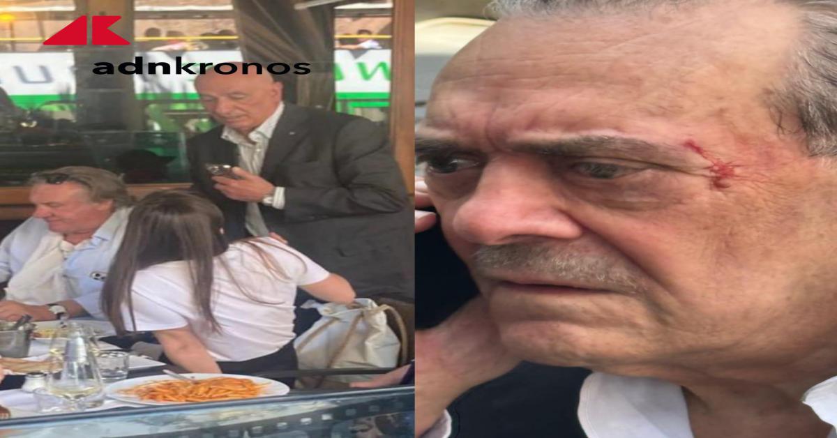 Aggressione a Barillari - Depardieu e la compagna hanno lasciato l