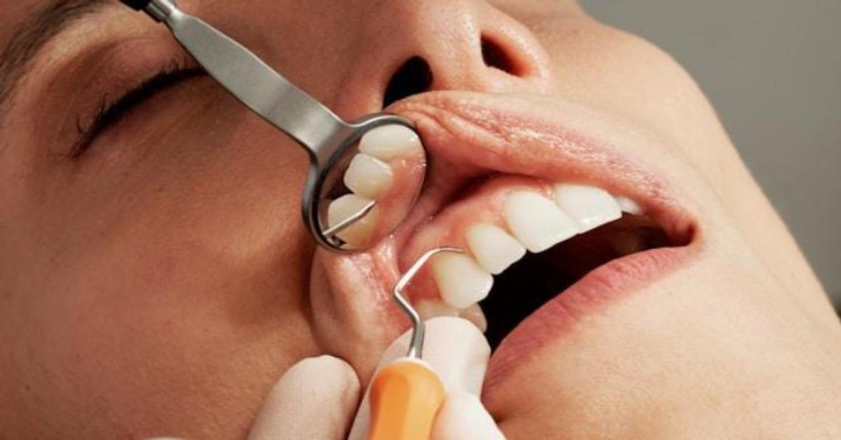 Cura dei denti: 5 consigli per un