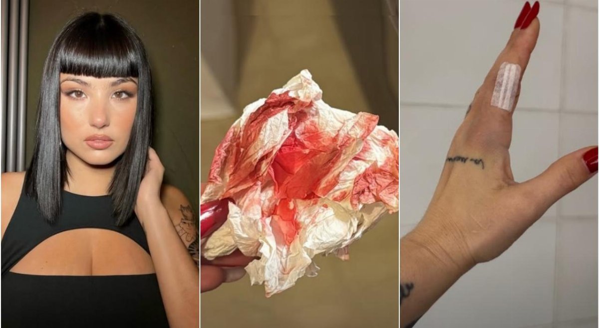 Giorgia Soleri ricoverata dopo un taglio accidentale: cos