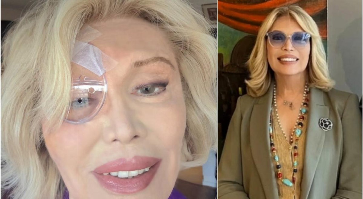 Amanda Lear operata agli occhi per la terza volta in due mesi