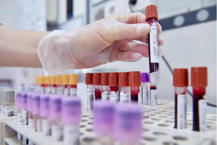 cancro alla cancro alla