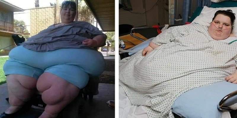 Georgia Davis era l'adolescente più obesa del mondo, la sua trasformazione è straordinaria