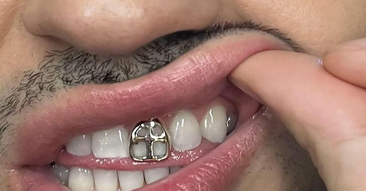 gioielli denti