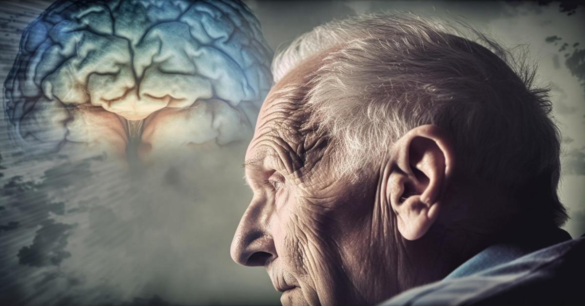 Alzheimer: Scoperti segnali predittivi 18 anni prima della manifestazione clinica